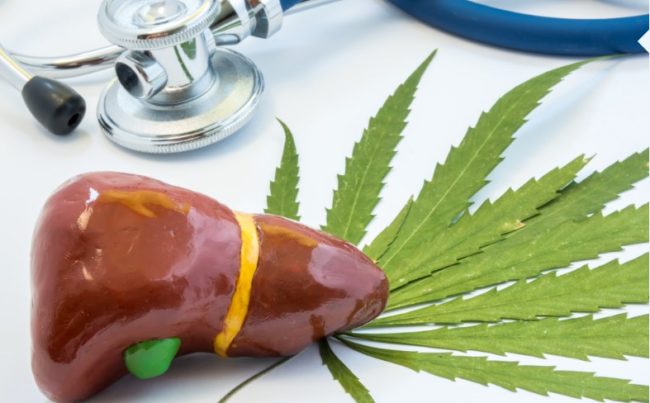 le cannabis pour réduire les dommages au foie causés par l'alcool