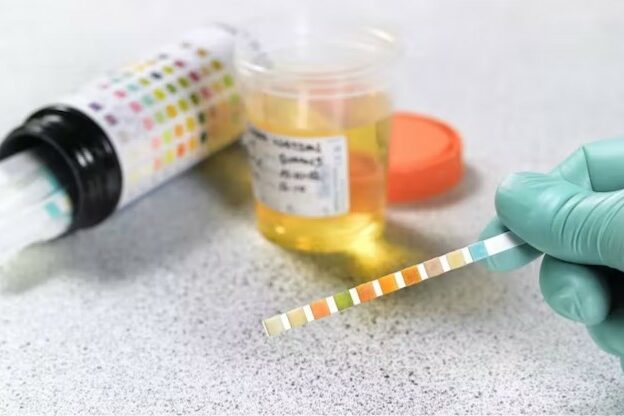 cannabis-une nouvelle étude remet en question les tests de dépistage