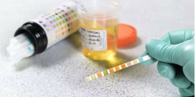 cannabis-une nouvelle étude remet en question les tests de dépistage