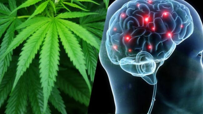 CBD - Cerveau - Cannabis